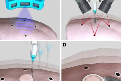 《Science》子刊：在活體器官上原位3D打印可變形水凝膠傳感器！