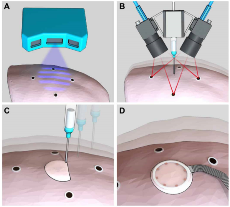 《Science》子刊：在活體器官上原位3D打印可變形水凝膠傳感器！