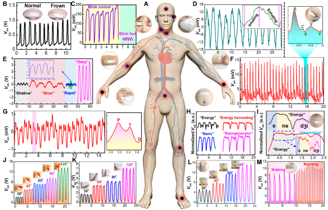 王中林院士團(tuán)隊《Science》子刊：透氣、抗菌、可降解電子皮膚！