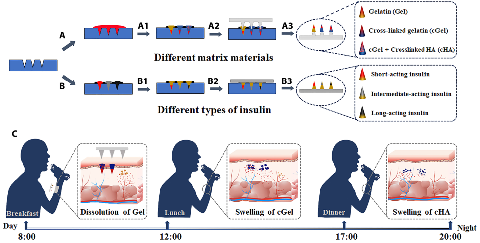 北京化工大學郭新東《Sci.Adv.》：無痛貼片！貼一片，血糖穩(wěn)一天