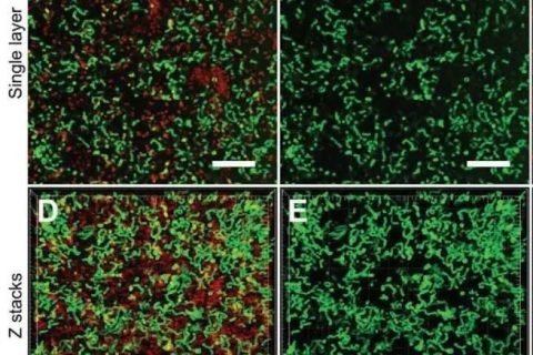 新加坡國(guó)立大學(xué)《AFM?》：肉眼可見(jiàn)！共軛低聚電解質(zhì)助力革蘭氏細(xì)菌的區(qū)分