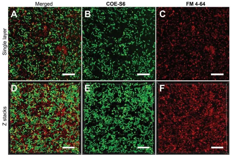 新加坡國(guó)立大學(xué)《AFM?》：肉眼可見(jiàn)！共軛低聚電解質(zhì)助力革蘭氏細(xì)菌的區(qū)分