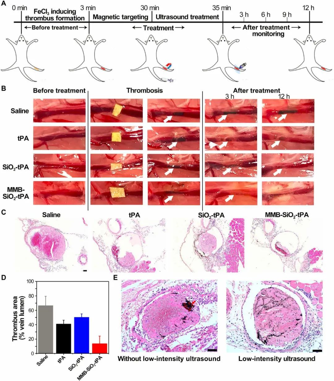 南京郵電大學(xué)汪聯(lián)輝、高宇《Sci. Adv.》：磁場、超聲波助力納米組裝體加速溶栓