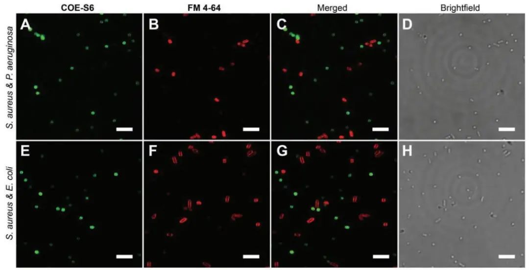 新加坡國(guó)立大學(xué)《AFM?》：肉眼可見(jiàn)！共軛低聚電解質(zhì)助力革蘭氏細(xì)菌的區(qū)分