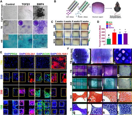 打破軟骨不可再生壁壘，《Science》子刊： 具有雙因子釋放和梯度結構3D生物打印構建體，用于異質軟骨再生