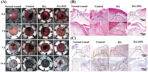 不懼腫瘤術(shù)后復(fù)發(fā)！上交大李海燕《AFM》：用于內(nèi)部組織修復(fù)和抗術(shù)后粘連的Janus水凝膠濕粘合劑，