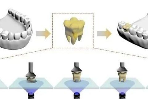 強(qiáng)大，一滴樹(shù)脂就能打印一顆牙齒！中科院化學(xué)所實(shí)現(xiàn)單液滴3D打印技術(shù)