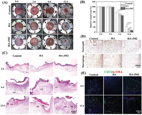 不懼腫瘤術(shù)后復(fù)發(fā)！上交大李海燕《AFM》：用于內(nèi)部組織修復(fù)和抗術(shù)后粘連的Janus水凝膠濕粘合劑，