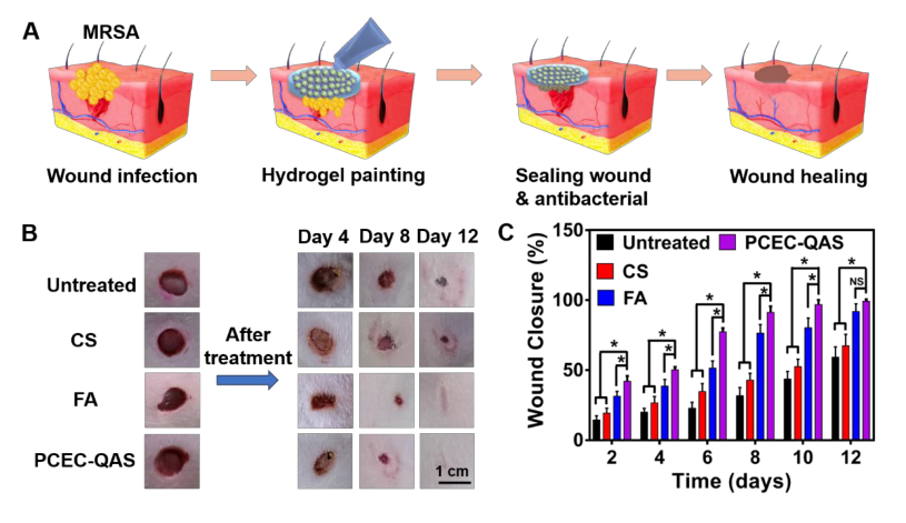 醫(yī)科院王偉偉等《ACS Nano》：直達(dá)真皮層，100%修復(fù)：合成高分子抗菌水凝膠用于耐甲氧西林金黃色葡萄球菌感染傷口愈合