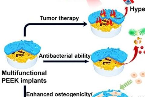 四川大學鄧怡團隊《ACS AMI》：為醫(yī)用特種高分子尋“醚”新功能——具有抗癌抑菌雙功能的聚醚醚酮植入材料