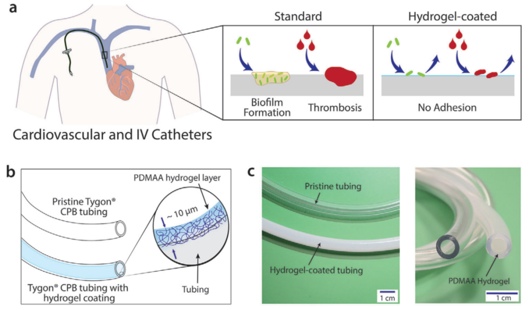 MIT趙選賀教授：超薄、耐用的水凝膠涂層：可同時(shí)減輕血栓和感染性并發(fā)癥